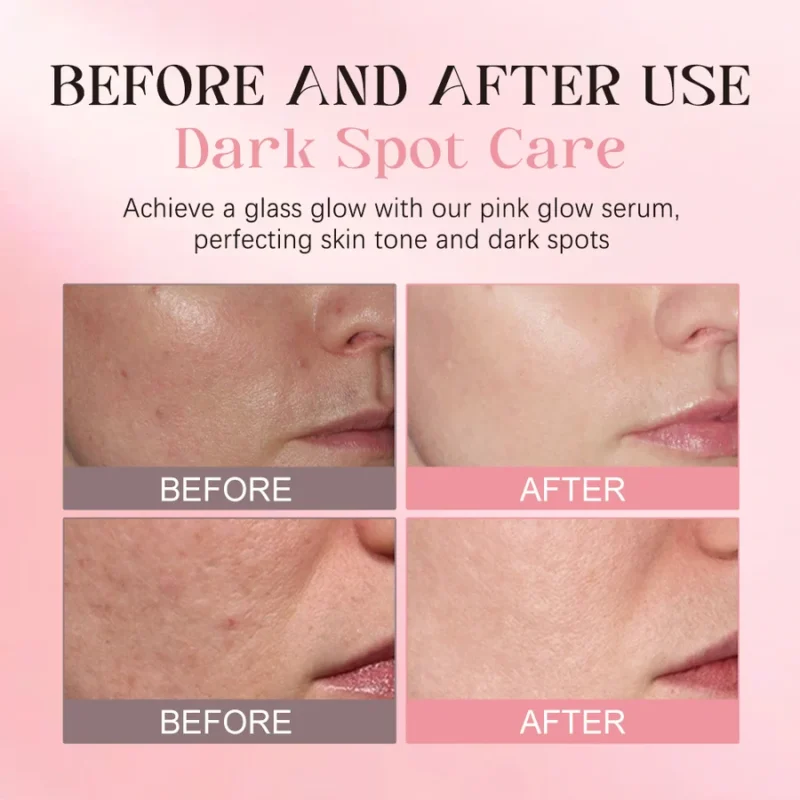 4_d04d2946-8778-408f-9f67-61fb09959738_900x Pink PDRN Facial Serum
