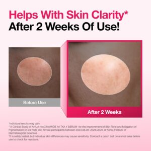 71yJvBge7+L._AC_SL1500_ Anua Niacinamide 10% + TXA 4% Serum
