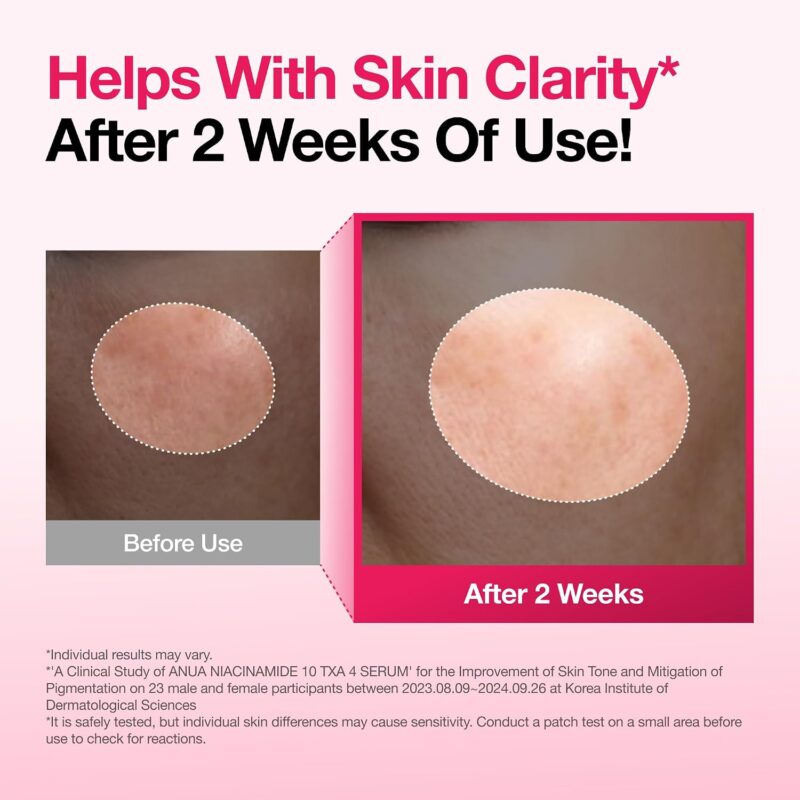 71yJvBge7+L._AC_SL1500_ Anua Niacinamide 10% + TXA 4% Serum